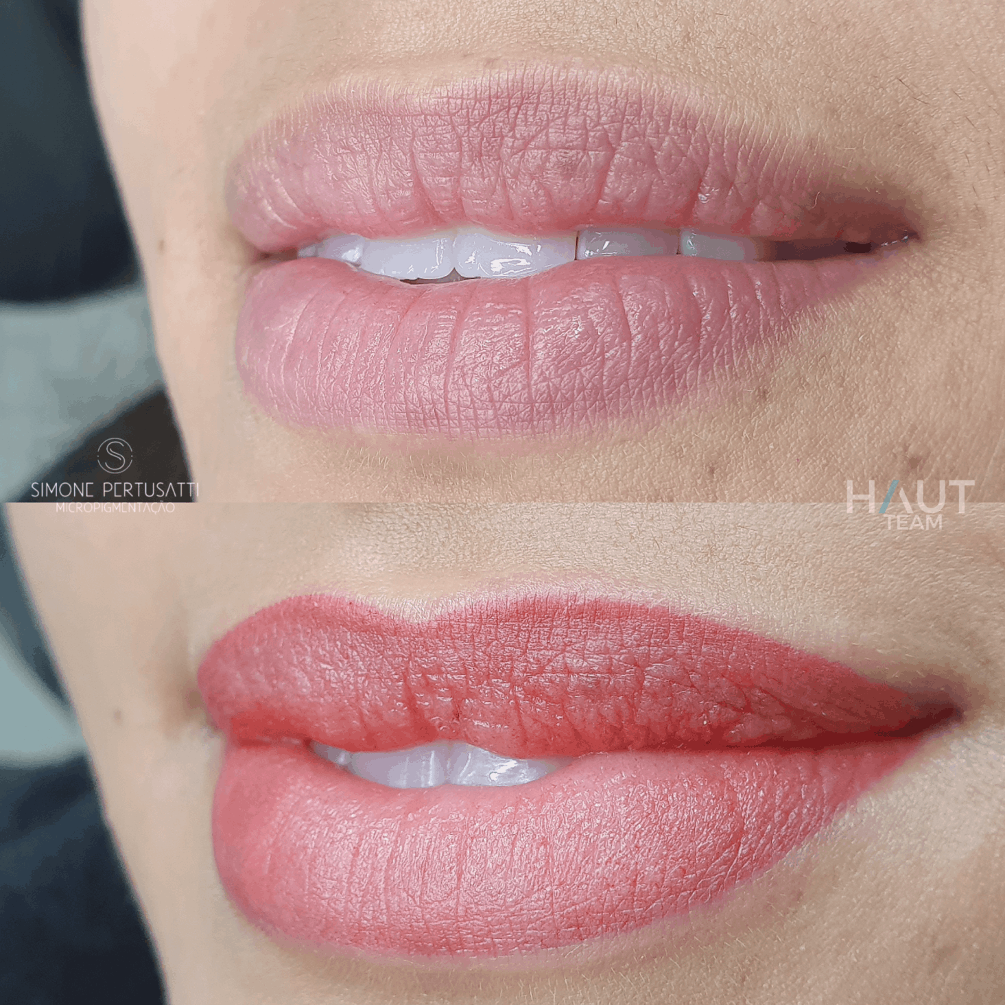 exemplo antes e depois micropigmentacao de labios em curitiba