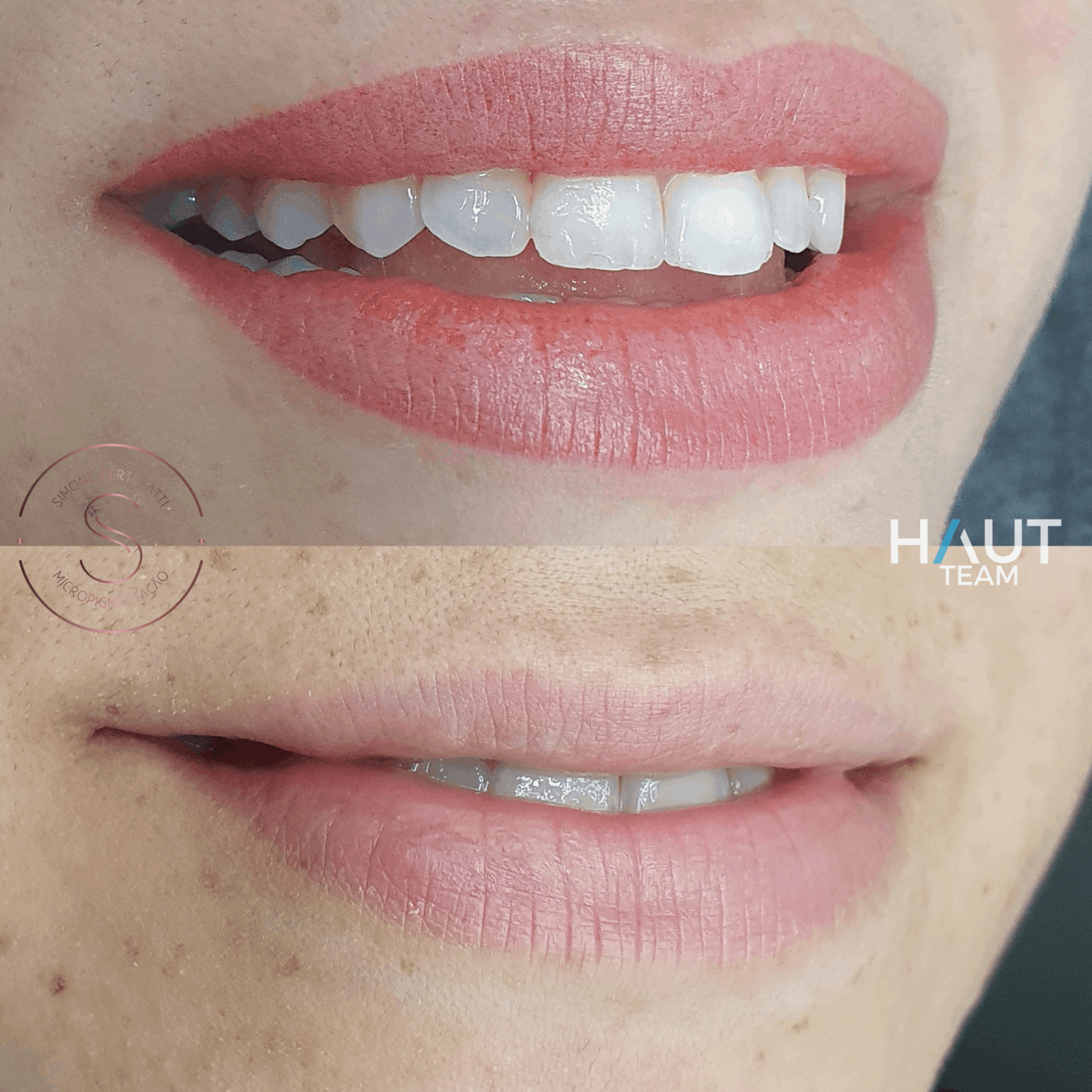 exemplo antes e depois micropigmentacao de labios em curitiba