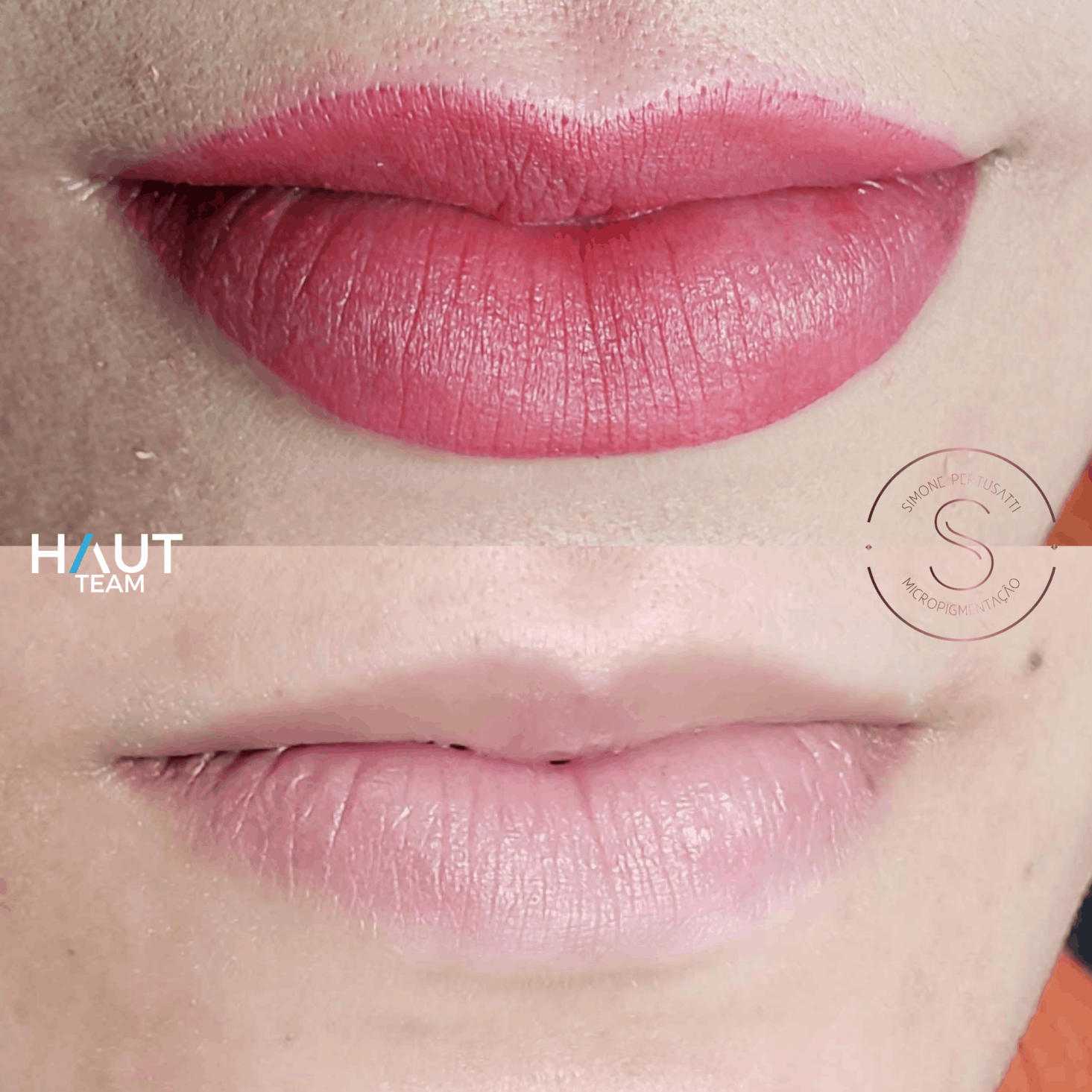 exemplo antes e depois micropigmentacao de labios em curitiba