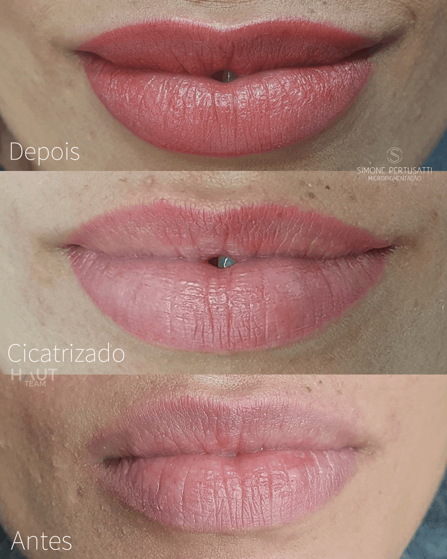 exemplo antes e depois micropigmentacao de labios em curitiba