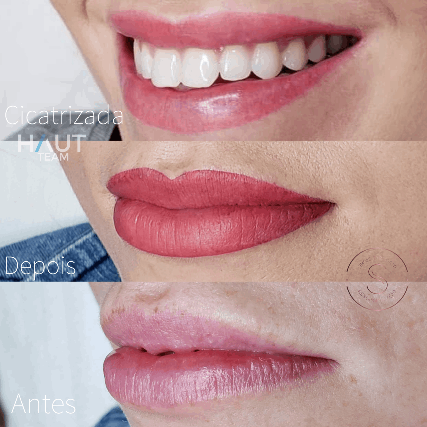 exemplo antes e depois micropigmentacao de labios em curitiba